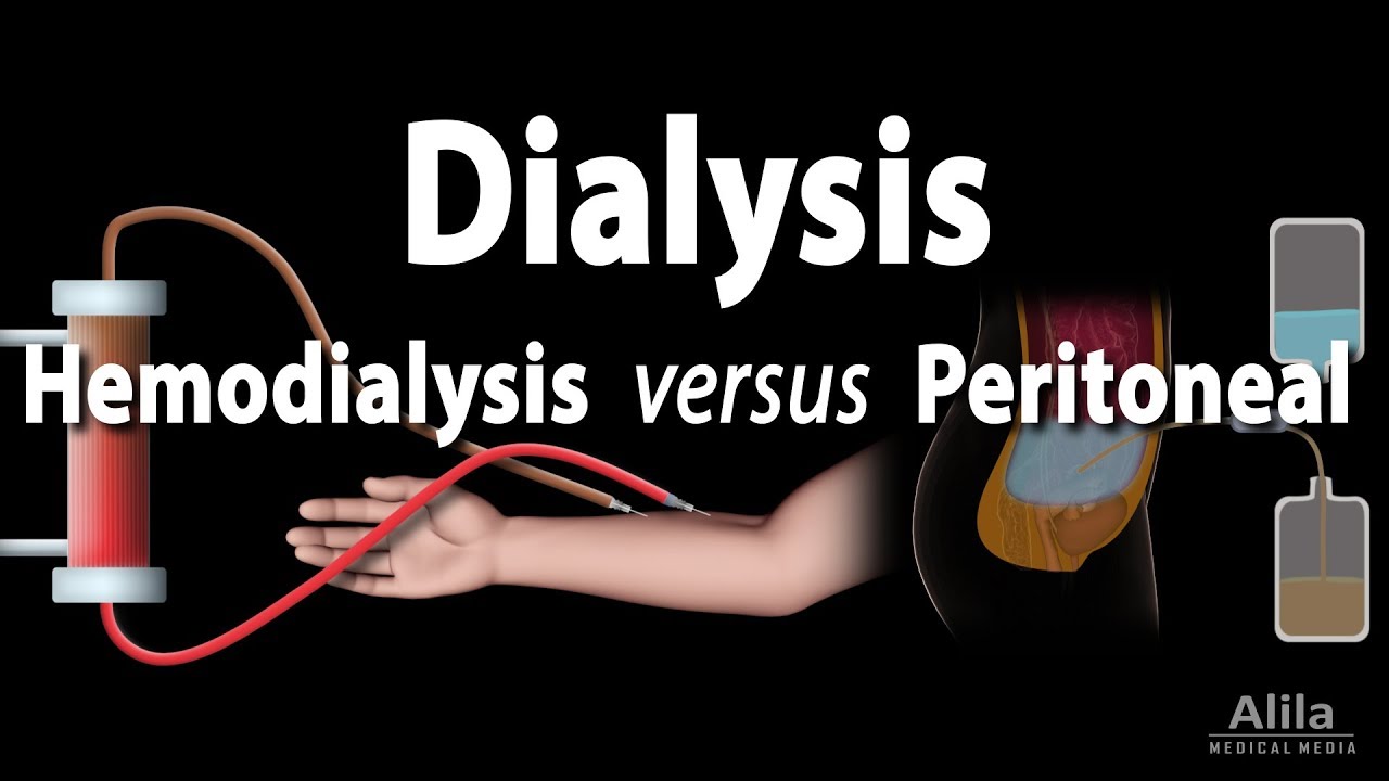 dialys