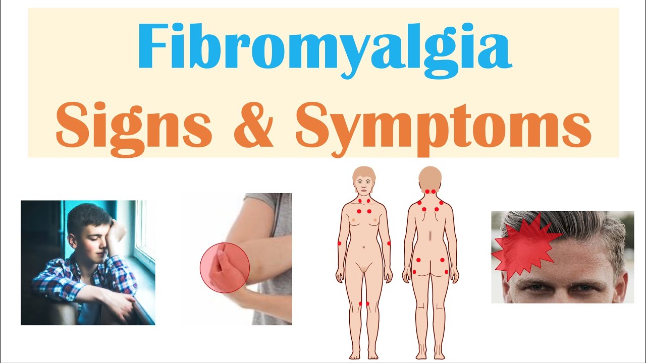 fibromyalgi symptom lista