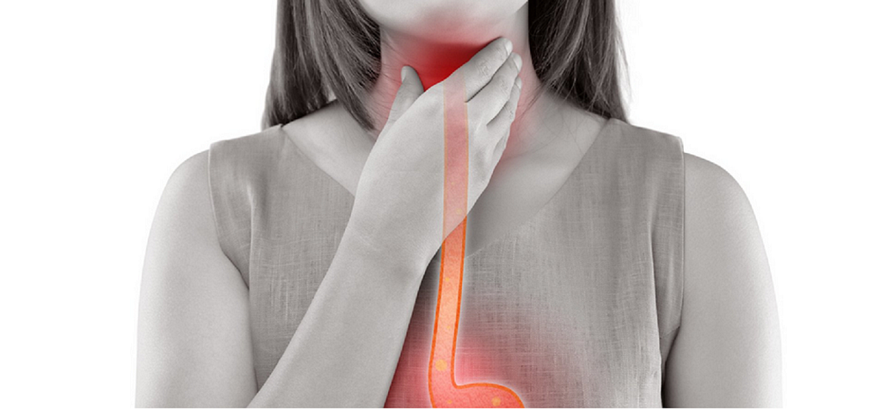 Acalasia: 5 claves para entender esta condición digestiva 3 acalasia